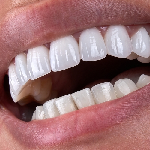 Enhance Your Smile with Cosmetic Dentistry